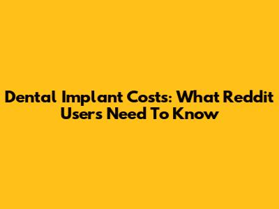 Dental Implant Costs: What Reddit Users Need To Know