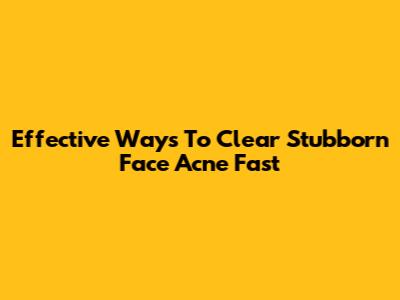 Effective Ways To Clear Stubborn Face Acne Fast