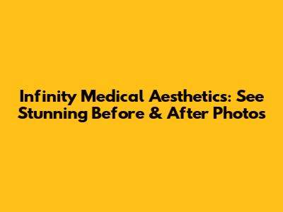 Infinity Medical Aesthetics: See Stunning Before & After Photos