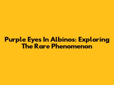 Purple Eyes In Albinos: Exploring The Rare Phenomenon