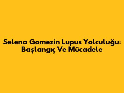 Selena Gomez'in Lupus Yolculuğu: Başlangıç Ve Mücadele