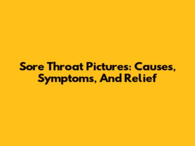 Sore Throat Pictures: Causes, Symptoms, And Relief