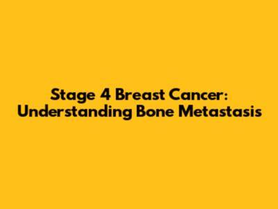 Stage 4 Breast Cancer: Understanding Bone Metastasis