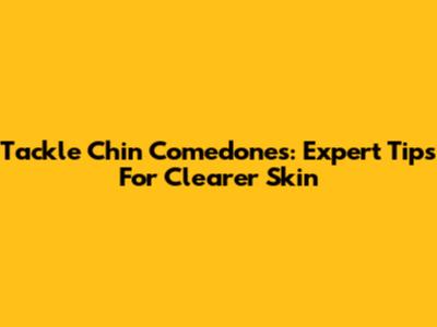 Tackle Chin Comedones: Expert Tips For Clearer Skin